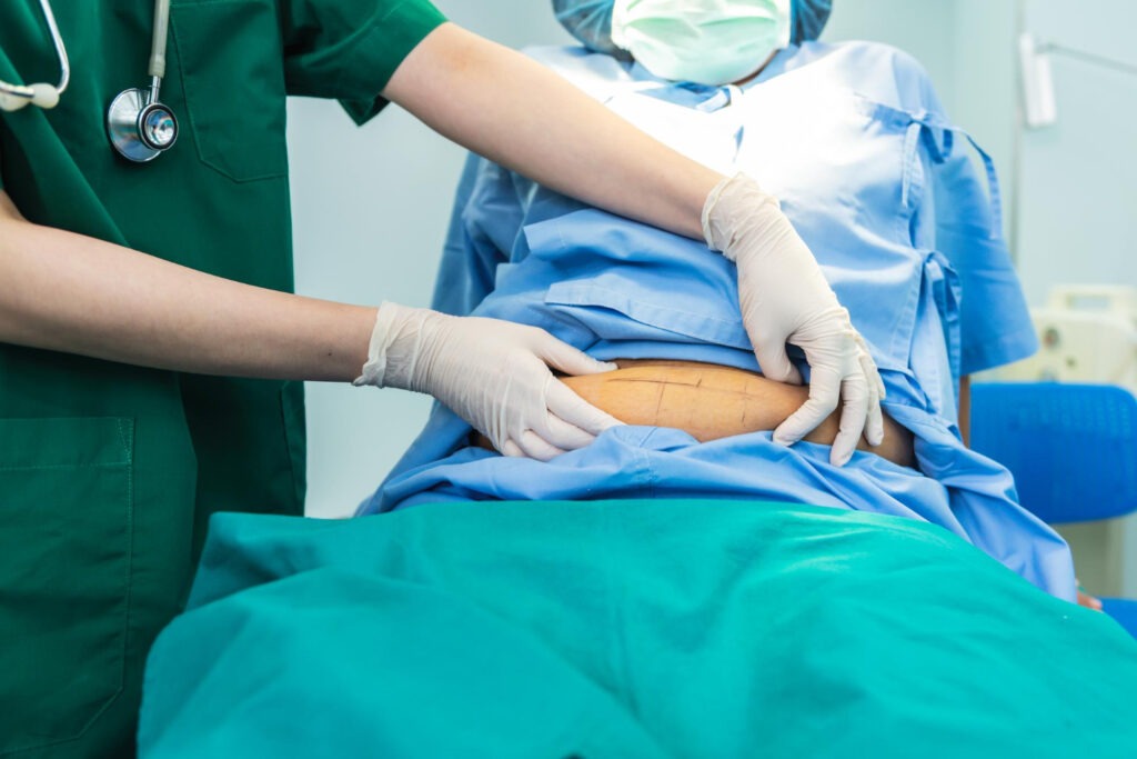 Patient undergoing bariatric surgery in Turkey