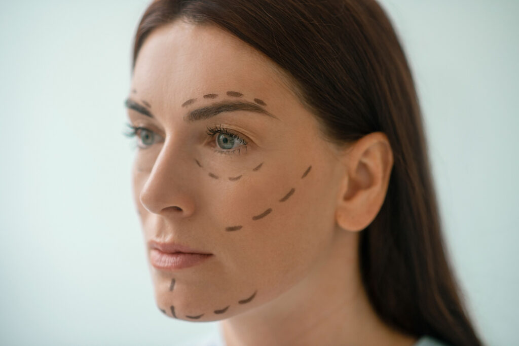 Patient undergoing plastic surgery procedures in Turkey