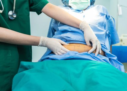 Patient undergoing bariatric surgery in Turkey